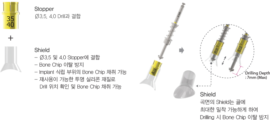 InnoGenic™ Autobone Harvester 제품소개:For Ø3.5 & 4.0 Drill