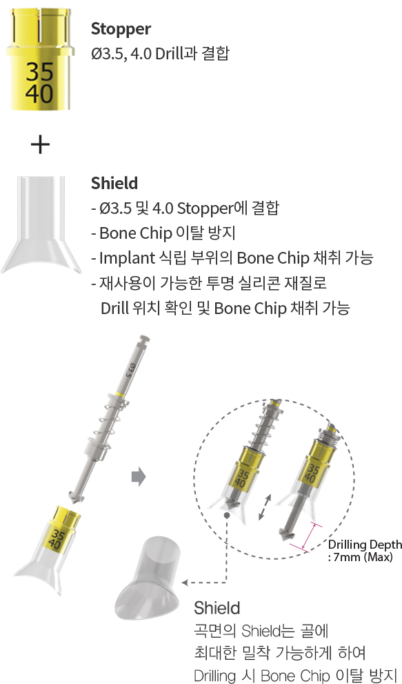 InnoGenic™ Autobone Harvester 제품소개:For Ø3.5 & 4.0 Drill