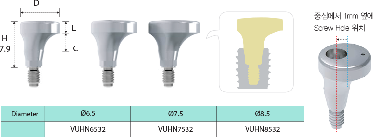 Volume-Up™ Guide System 제품구성
