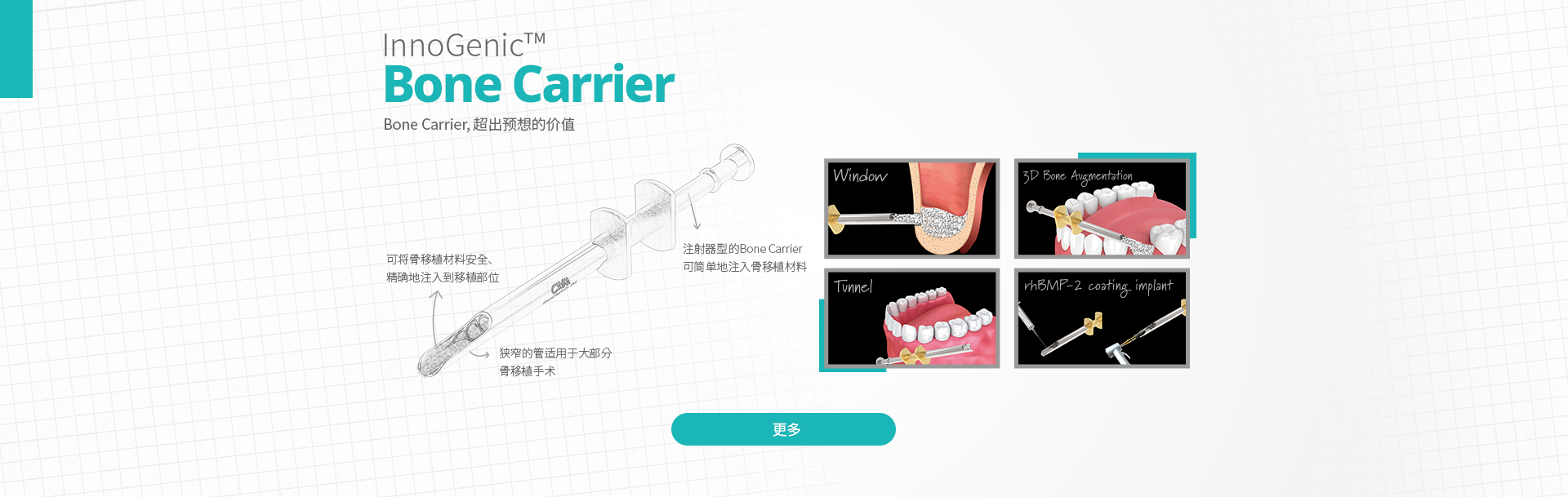 InnoGenic™ Bone Carrier