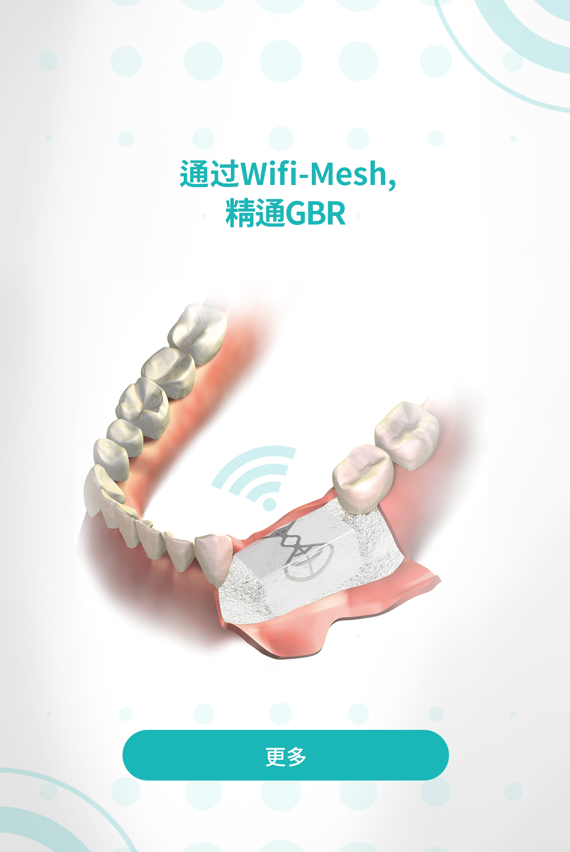 InnoGenic™ Wifi-mesh