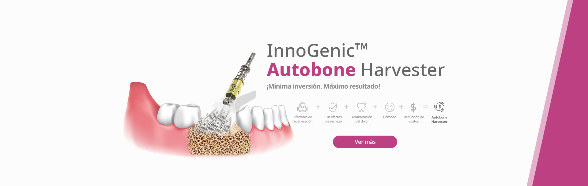 InnoGenic™ Autobone Harvester