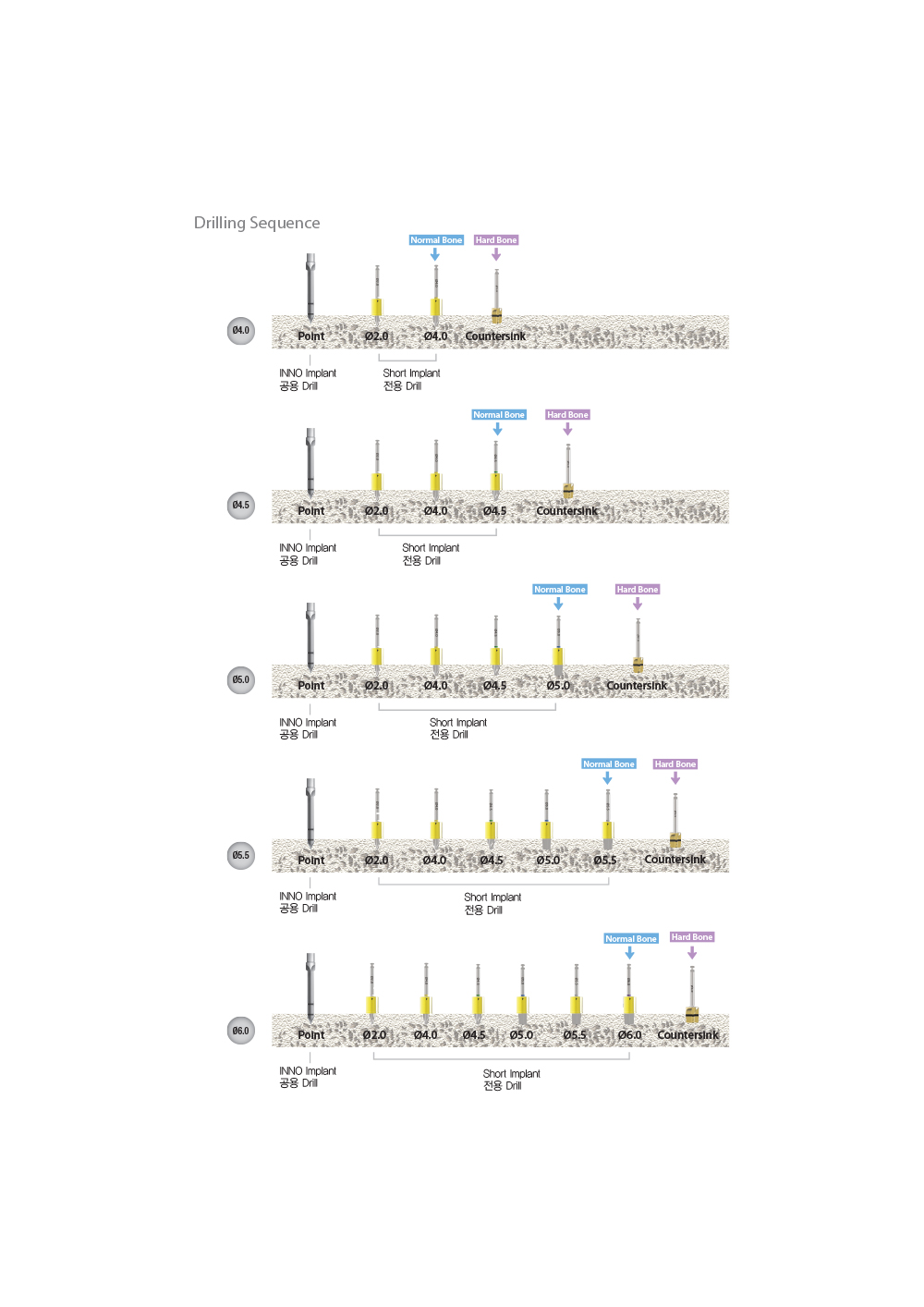 Fixture 포장 개봉방법